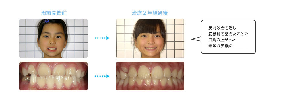 Kodomo矯正 東大阪八戸ノ里の歯科 なんごうや歯科医院