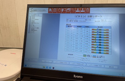 スキャンアナライザー